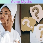 Acne Myths
