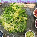 Does Diet Affect Acne