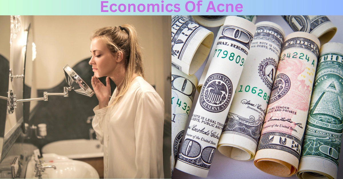 Economics Of Acne