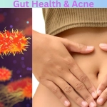 Gut Health & Acne